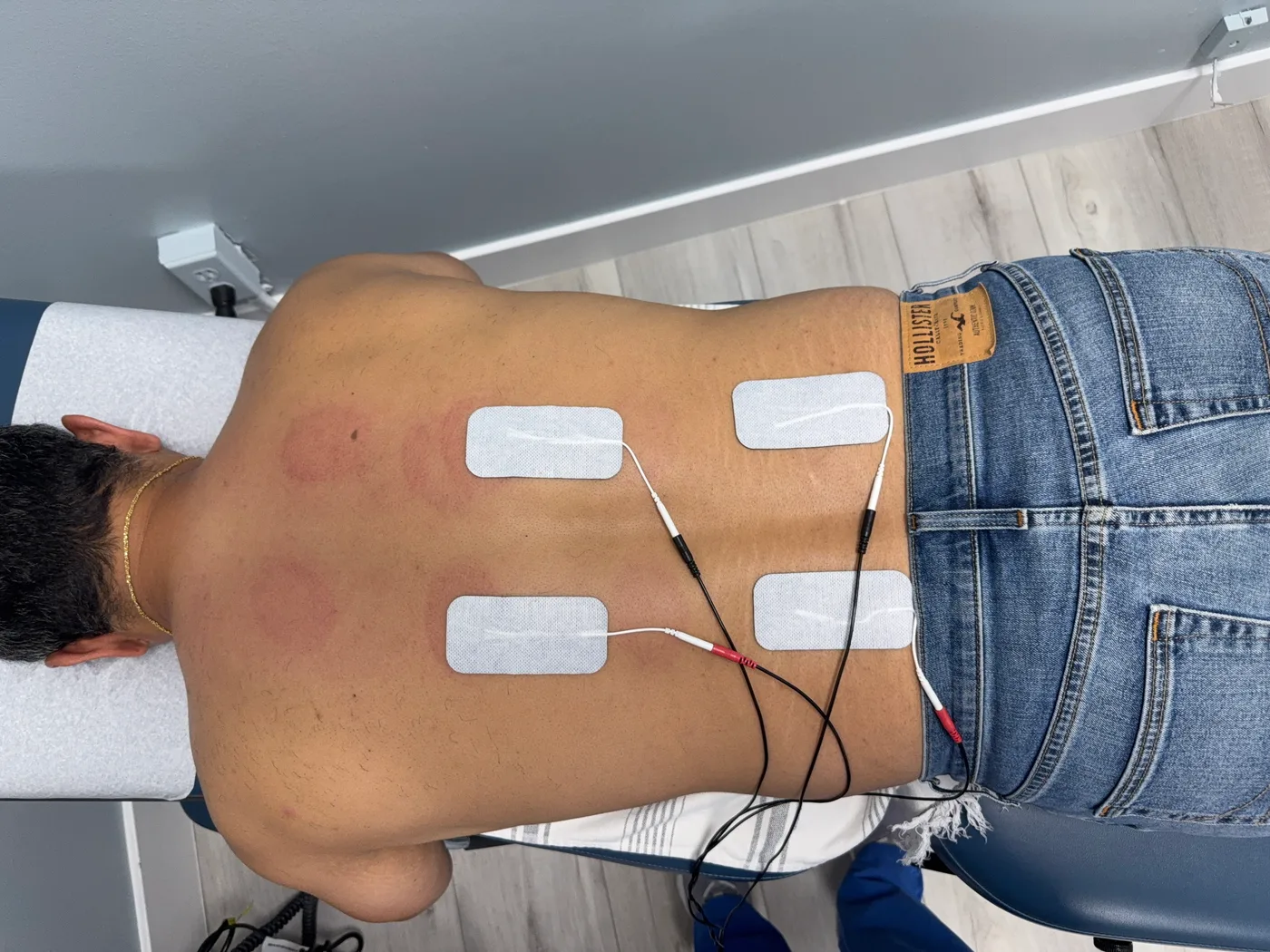 Electrical Muscle Stimulation (EMS) at Divine Healing Chiropractic in Laguna Niguel
